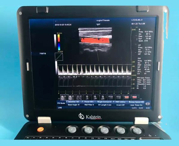 128 Item 3D Medical THI Ultrasound Machine For Sale With Convex Probe YR05148 - Image 2